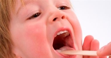 أعراض التهاب الحلق وطرق منزلية لعلاجه