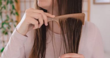 Photo of لو بتعانى من قشرة الرأس.. إليك 5 أطعمة يجب إضافتها لنظامك الغذائى للتخلص منها