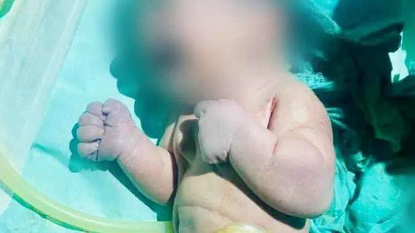Photo of حالة نادرة.. سيدة تضع مولودا أثناء معاناتها من غيبوبة سكر في المنوفية